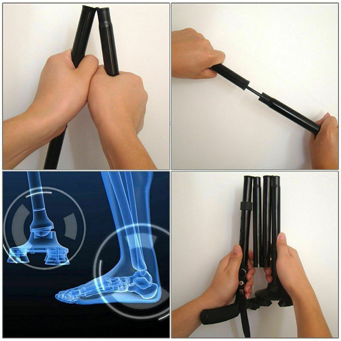 Collage of a foot stretcher being used with close-up shots and an X-ray image.