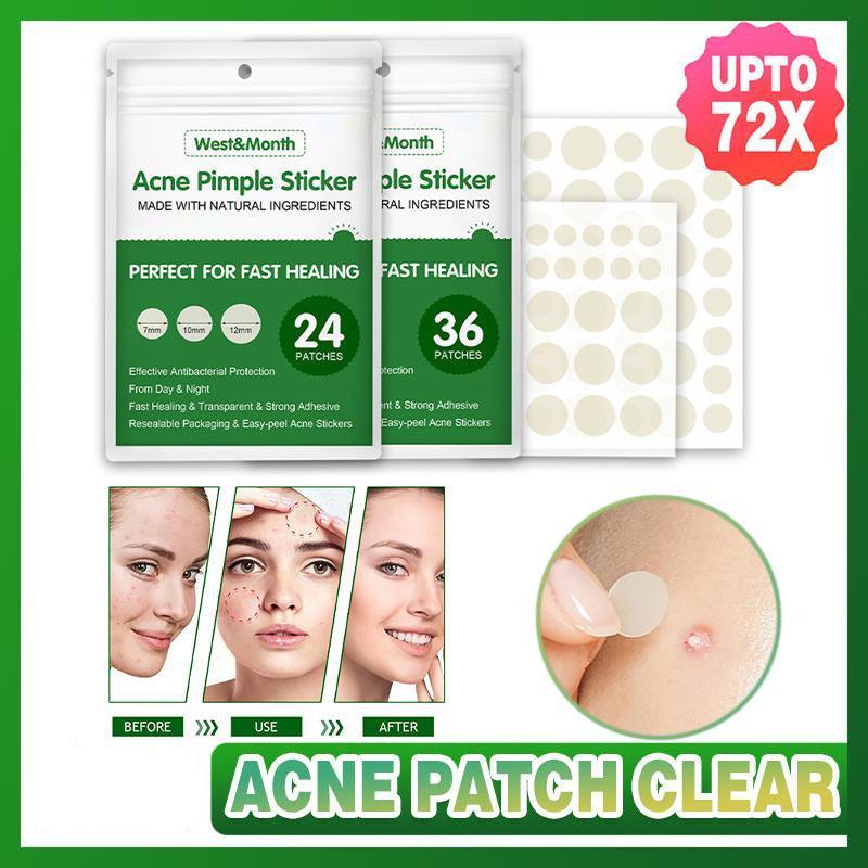 Acne pimple stickers with packaging and before-after images on a green background