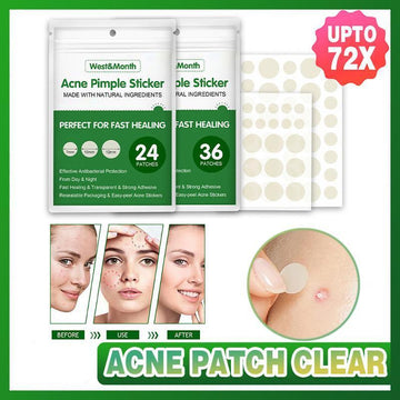 Acne pimple stickers with packaging and before-after images on a green background