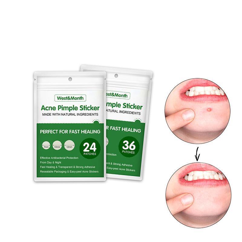West&Month Acne Pimple Sticker packaging with before and after effects on a white background