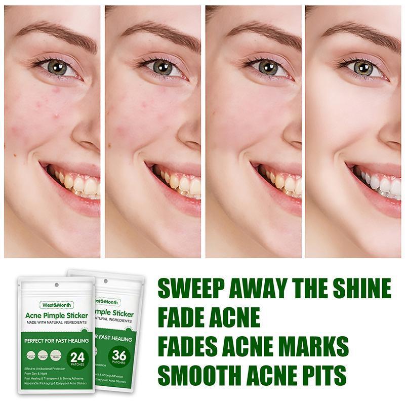 Before and after effects of using acne stickers with text highlighting benefits.