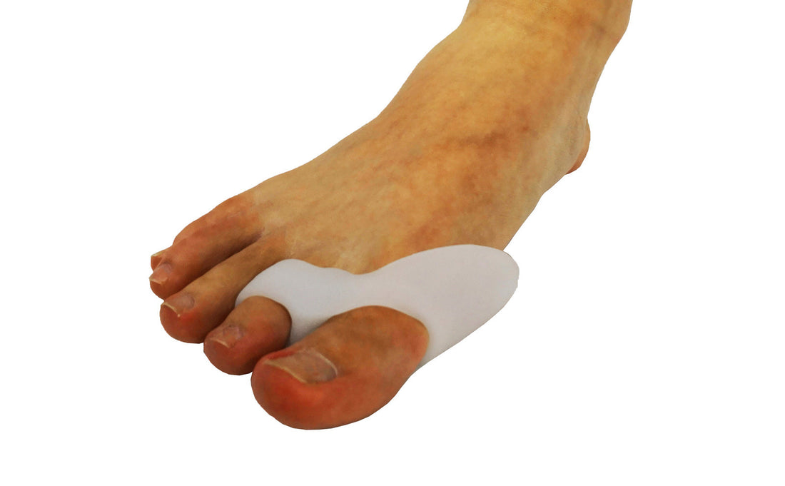 Foot with a bunion corrector on a white background