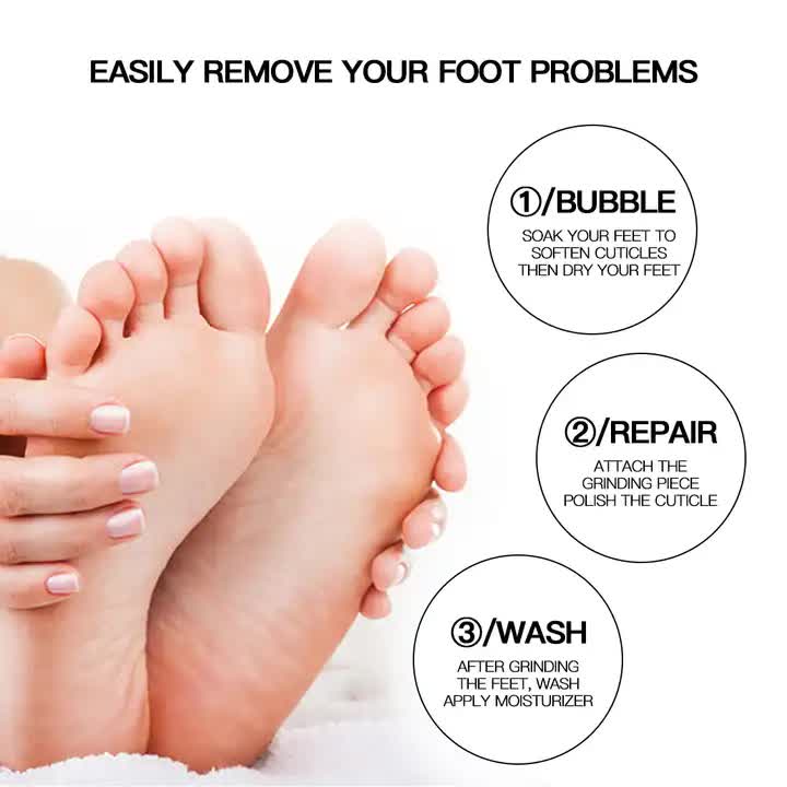 Steps to remove foot problems with a close-up of feet and text instructions.